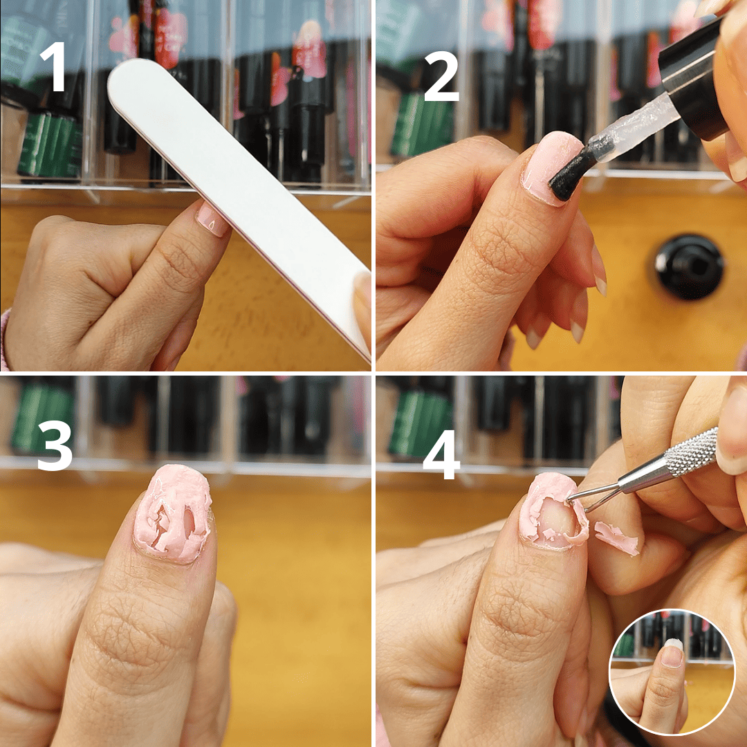 Kit Remoção Express: O Fim da Remoção Difícil